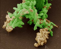 Geobacter; de ijzer-ademende microbe. Foto: Derek Lovley, Kelly Nevin & Ben Barnhart, University of Massachusetts'