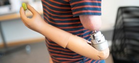 Breingestuurde armprotheses die ‘voelen’ zijn in Zweden al onderdeel van het dagelijks leven